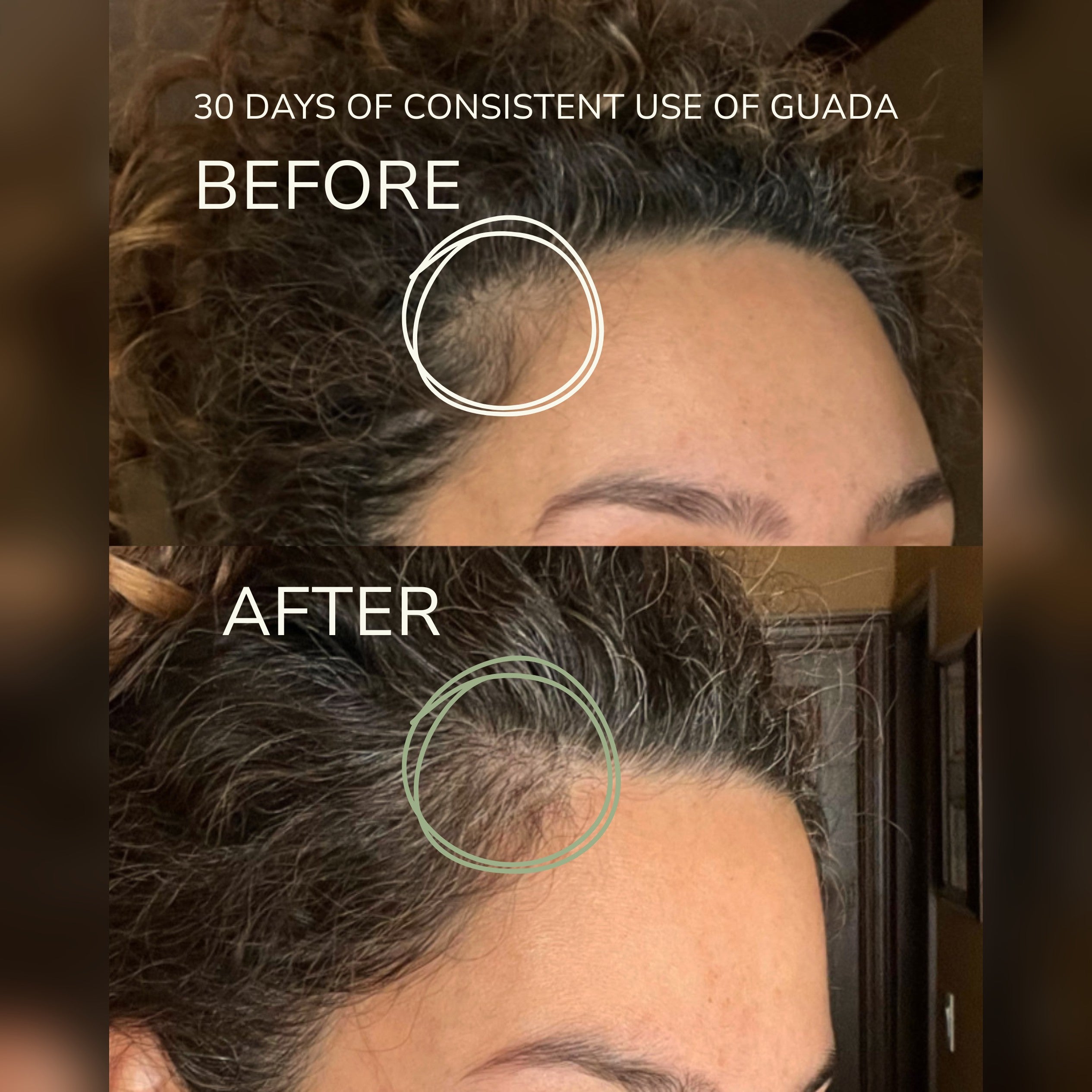 30 days of consistent Guada use, before and after